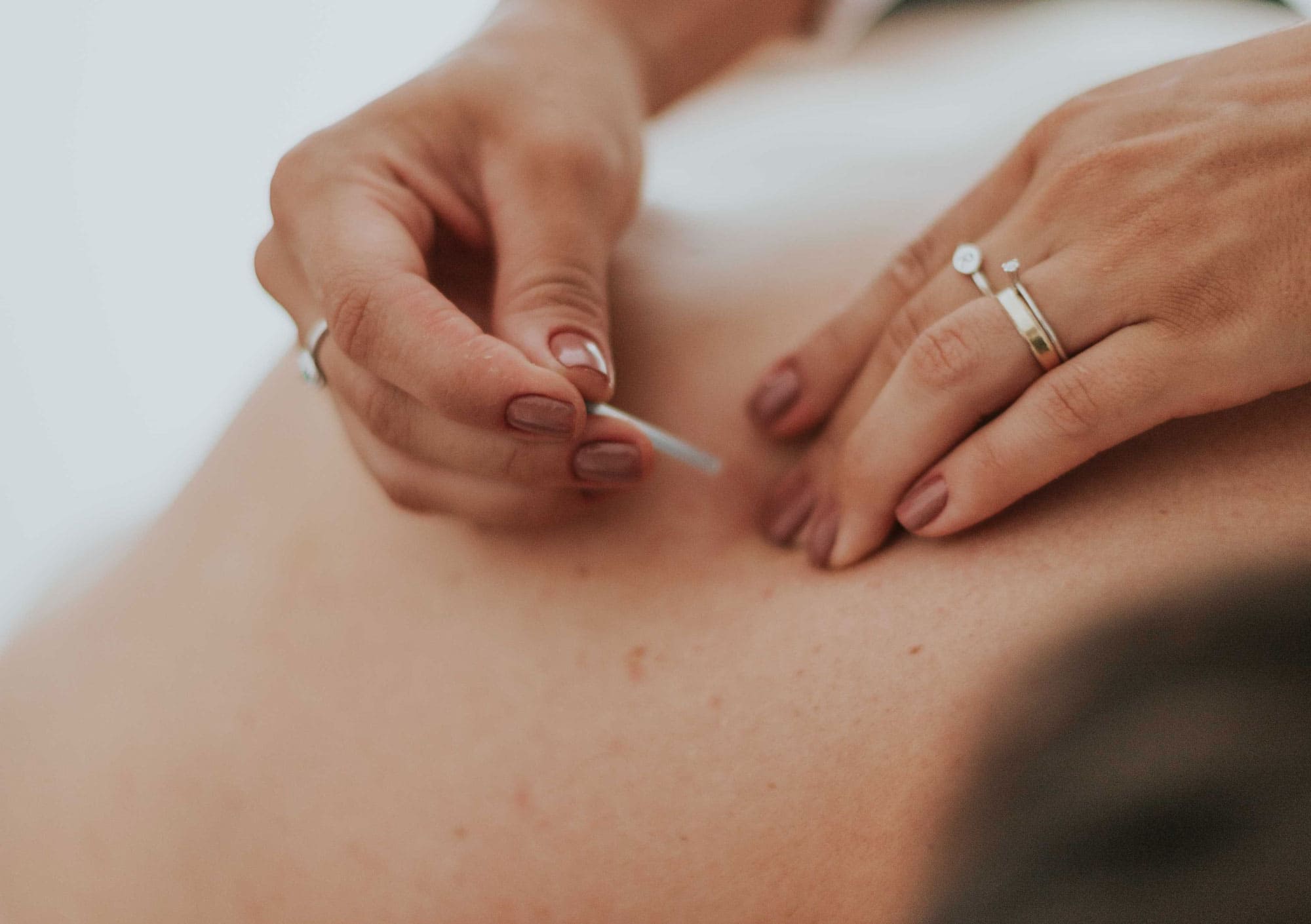 male-fertility-acupuncture-verity-paz-clinic